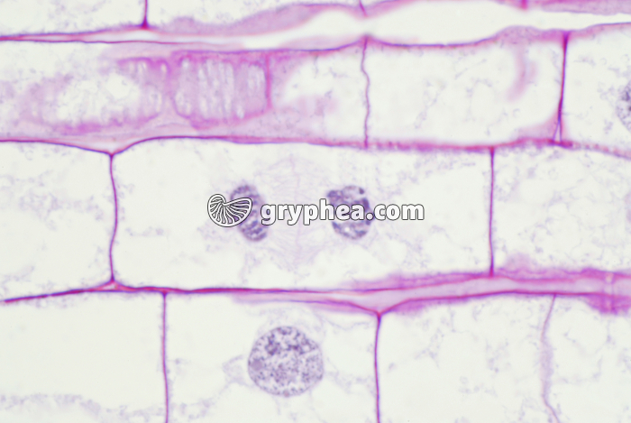 Mitose dans une racine de Blé (télophase) x200  - gryphea.com